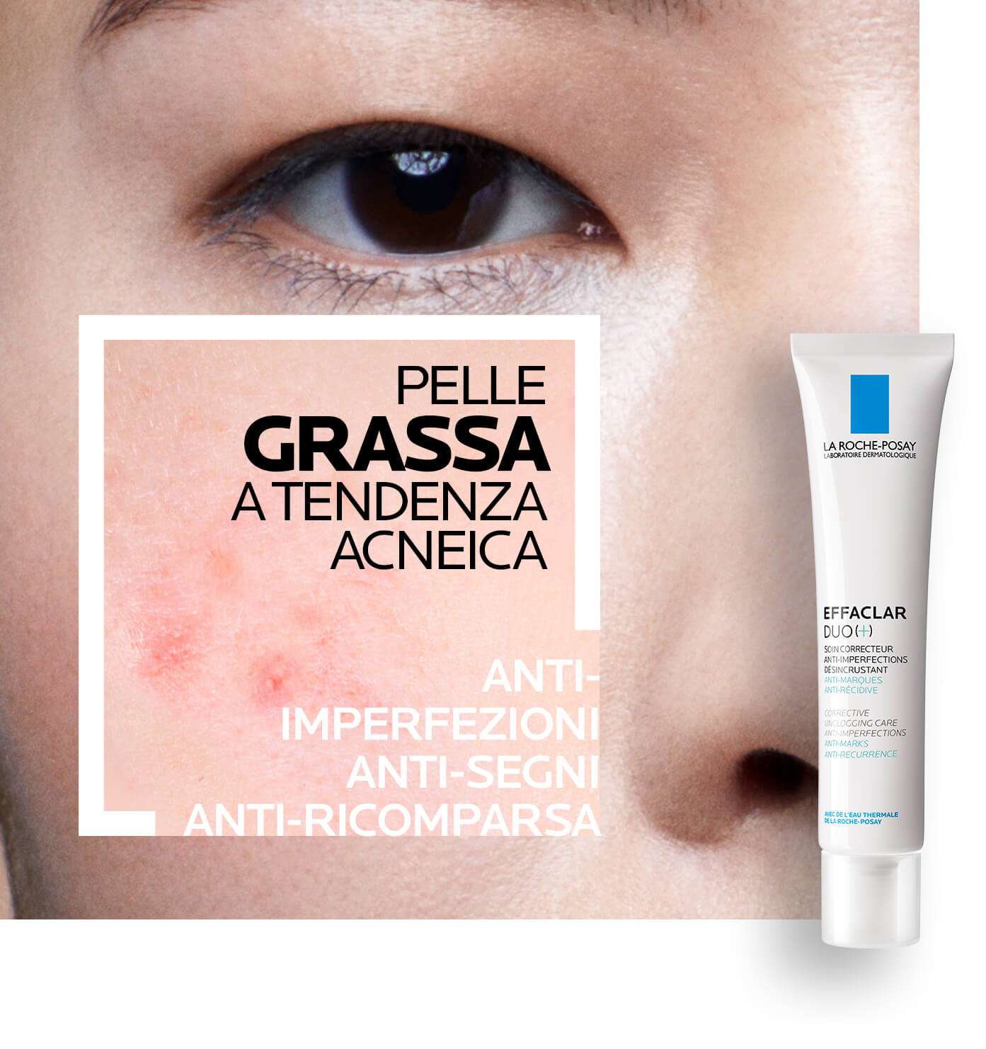 La Roche-Posay - Pelle grassa